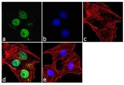 Invitrogen OTX2 Recombinant Rabbit Monoclonal Antibody (14H14L5) 100 &mu;g;