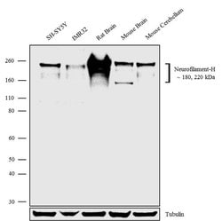 Invitrogen NF-H Recombinant Rabbit Monoclonal Antibody (4H6L2) 100 &mu;g | Buy Online | Invitrogen&trade; | Fisher Scientific