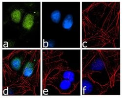 Invitrogen EVI1 Recombinant Rabbit Monoclonal Antibody (11H41L13) 100 &mu;g;