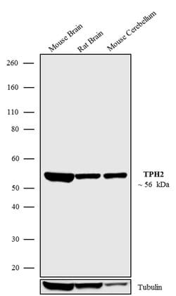 Invitrogen TPH2 Recombinant Rabbit Monoclonal Antibody (9H1L6) 100 &mu;g | Buy Online | Invitrogen&trade; | Fisher Scientific