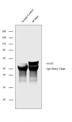 Invitrogen alpha-1 Antitrypsin Recombinant Rabbit Monoclonal Antibody (8H10L18)