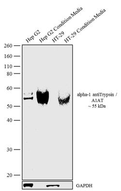 Invitrogen alpha-1 Antitrypsin Recombinant Rabbit Monoclonal Antibody (8H10L18)
