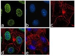 Invitrogen&trade;&nbsp;TBX3 Recombinant Rabbit Monoclonal Antibody (22H23L21)