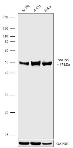 NSUN5 Recombinant Rabbit Monoclonal Antibody (9H9L15) 100 &mu;g | Buy Online | Thermo Scientific | Fisher Scientific