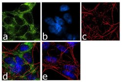 Invitrogen SLC6A4 Recombinant Rabbit Monoclonal Antibody (16H2L7) 100 &mu;g;
