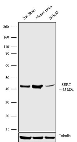 Invitrogen SLC6A4 Recombinant Rabbit Monoclonal Antibody (16H2L7) 100 &mu;g;