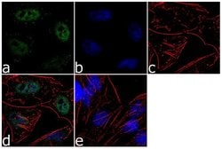 Invitrogen RAD1 Recombinant Rabbit Monoclonal Antibody (8H19L13) 100 &mu;g;