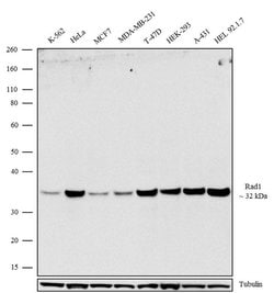 Invitrogen RAD1 Recombinant Rabbit Monoclonal Antibody (8H19L13) 100 &mu;g;