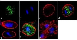 Phospho-Vimentin (Ser39) Recombinant Rabbit Monoclonal Antibody (3H9L2):Antibodies,