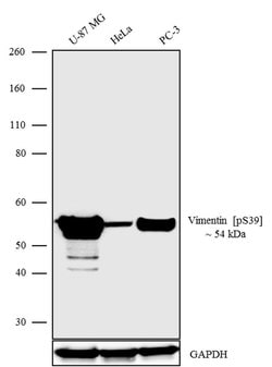 Phospho-Vimentin (Ser39) Recombinant Rabbit Monoclonal Antibody (3H9L2):Antibodies,
