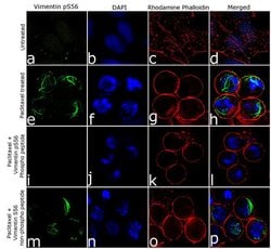 Invitrogen Phospho-Vimentin (Ser56) Recombinant Rabbit Monoclonal Antibody