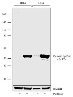 Invitrogen Phospho-Vimentin (Ser56) Recombinant Rabbit Monoclonal Antibody