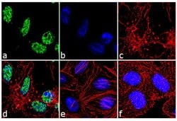 Invitrogen PARP1 Recombinant Rabbit Monoclonal Antibody (8H2L9) 100 &mu;g;