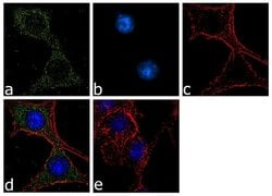 Invitrogen&trade;&nbsp;Calbindin D28K Recombinant Rabbit Monoclonal Antibody (5H25L2)
