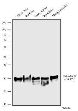 Invitrogen Calbindin D28K Recombinant Rabbit Monoclonal Antibody (5H25L2) 100 &mu;g | Buy Online | Invitrogen&trade; | Fisher Scientific