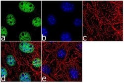 Invitrogen BAF53A Recombinant Rabbit Monoclonal Antibody (5H3L6) 100 &mu;g;