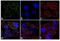 Invitrogen JAK2 Recombinant Rabbit Monoclonal Antibody (18H11L8) 100 &mu;g;