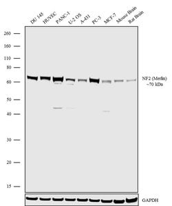 NF2 Recombinant Rabbit Monoclonal Antibody (1H27L4):Antibodies, Recombinant