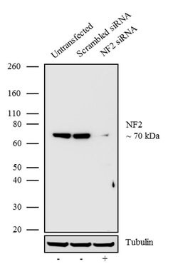 NF2 Recombinant Rabbit Monoclonal Antibody (1H27L4):Antibodies, Recombinant