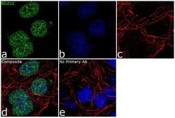 Invitrogen SUZ12 Recombinant Rabbit Monoclonal Antibody (7H26L21) 100 &mu;g;