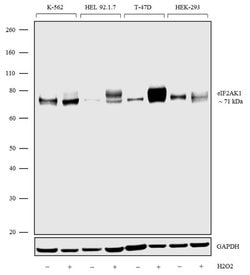 Invitrogen HRI Recombinant Rabbit Monoclonal Antibody (7H3L3) 100 &mu;g;