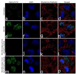 Invitrogen&trade;&nbsp;Phospho-CDK4 (Thr172) Recombinant Rabbit Monoclonal Antibody (9H2L7)