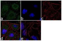 Invitrogen ALDH1L1 Recombinant Rabbit Monoclonal Antibody (19H14L20) 100