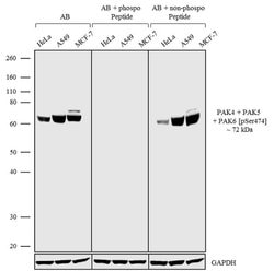 Phospho-PAK4/6/7 (Ser474) Recombinant Rabbit Monoclonal Antibody (1H7L3):Antibodies,