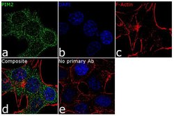 Invitrogen PIM2 Recombinant Rabbit Monoclonal Antibody (5H66L51) 100 &mu;g;