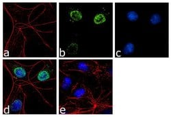 Invitrogen FOXN3 Recombinant Rabbit Monoclonal Antibody (1H2L8) 100 &mu;g;