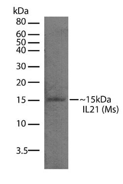 Invitrogen IL-21 Recombinant Superclonal Antibody (5HCLC) 100 &mu;g; Unconjugated:Antibodies,