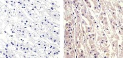 Invitrogen CXCL5 Recombinant Superclonal Antibody (9HCLC) 100 &mu;g; Unconjugated:Antibodies,
