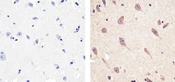 Invitrogen CXCL5 Recombinant Superclonal Antibody (9HCLC) 100 &mu;g; Unconjugated:Antibodies,