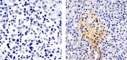 Invitrogen CXCL5 Recombinant Superclonal Antibody (9HCLC) 100 &mu;g; Unconjugated:Antibodies,