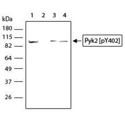 Invitrogen Phospho-PYK2 (Tyr402) Recombinant Superclonal Antibody (17HCLC)