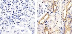 Invitrogen Phospho-AS160 (Thr642) Recombinant Superclonal Antibody (10HCLC)