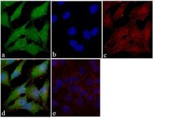 Invitrogen FAK Recombinant Superclonal Antibody (5HCLC) 100 &mu;g; Unconjugated:Antibodies,