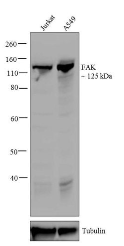 Invitrogen FAK Recombinant Superclonal Antibody (5HCLC) 100 &mu;g; Unconjugated:Antibodies,