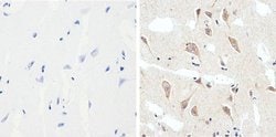 Invitrogen Phospho-Tau (Ser199) Recombinant Superclonal Antibody (2HCLC)