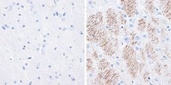 Invitrogen Phospho-Tau (Ser199) Recombinant Superclonal Antibody (2HCLC)