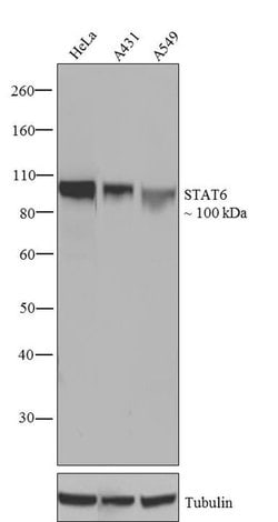 Invitrogen&trade;&nbsp;STAT6 Recombinant Superclonal&trade; Antibody (21HCLC)