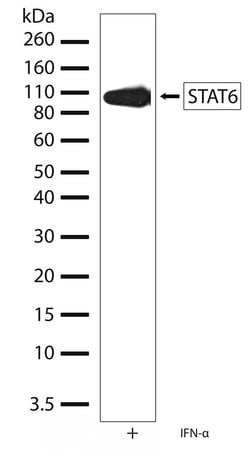 Invitrogen STAT6 Recombinant Superclonal Antibody (21HCLC) 100 &mu;g | Buy Online | Invitrogen&trade; | Fisher Scientific