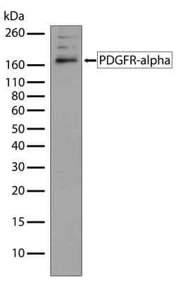 Invitrogen PDGFRA Recombinant Superclonal Antibody 100 &mu;g | Buy Online | Invitrogen&trade; | Fisher Scientific