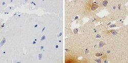 beta Amyloid Recombinant Superclonal Antibody (4HCLC):Antibodies, Recombinant