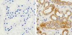 beta Amyloid Recombinant Superclonal Antibody (4HCLC):Antibodies, Recombinant