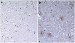 beta Amyloid Recombinant Superclonal Antibody (4HCLC):Antibodies, Recombinant