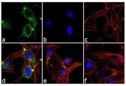 ANGPTL4 Recombinant Superclonal Antibody (1HCLC):Antibodies, Recombinant