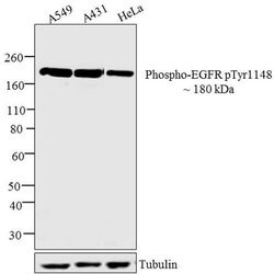 Invitrogen Phospho-EGFR (Tyr1148) Recombinant Superclonal Antibody (8HCLC)