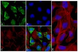 Invitrogen p70 S6 Kinase Recombinant Superclonal Antibody (15HCLC) 100