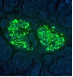 Invitrogen Insulin Recombinant Superclonal Antibody (19HCLC) 100 &mu;g;